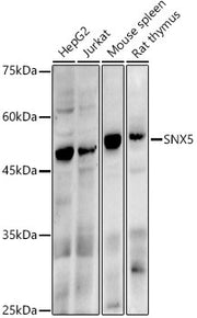 SNX5 Rabbit mAb