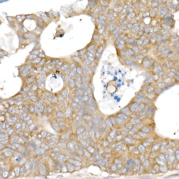 SNX5 Rabbit mAb