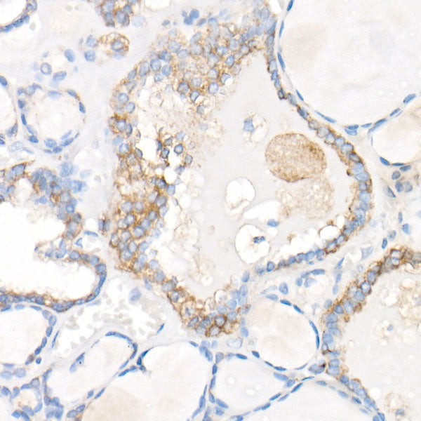 SNX5 Rabbit mAb