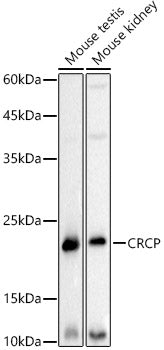 CRCP Rabbit mAb