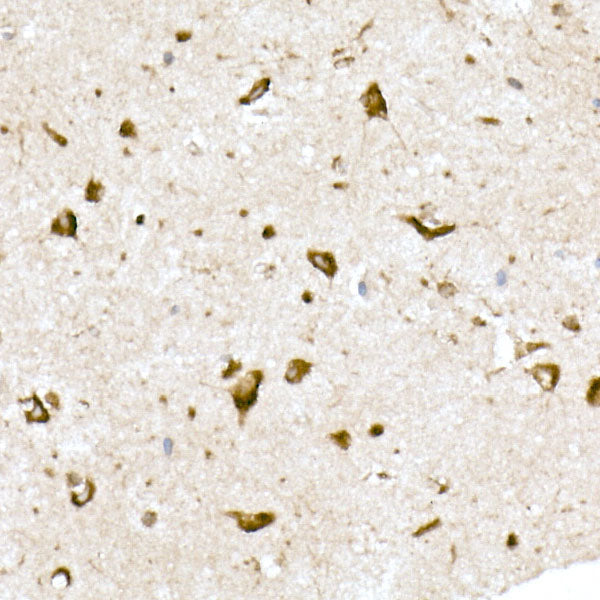 EMC4 Rabbit mAb