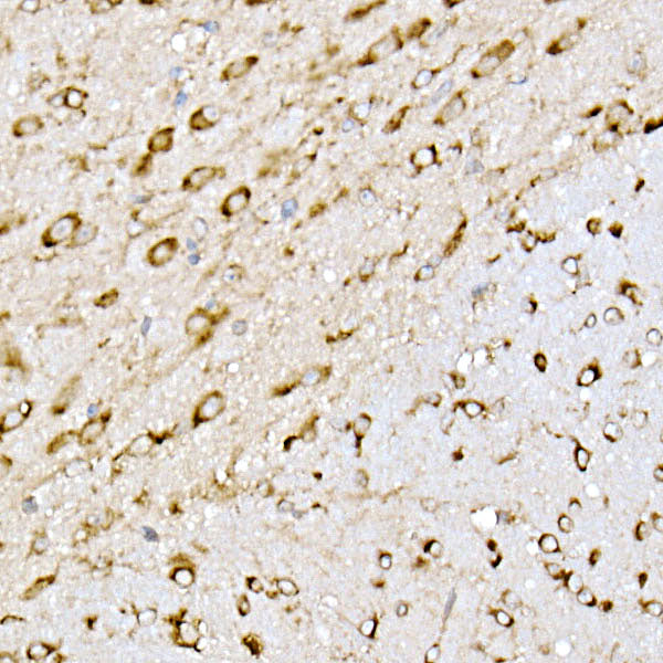 EMC4 Rabbit mAb