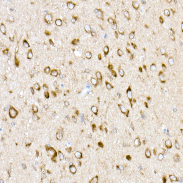 EMC4 Rabbit mAb