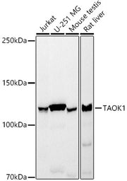 TAOK1 Rabbit mAb
