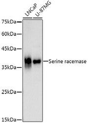 Serine racemase Rabbit mAb
