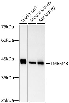 TMEM43 Rabbit mAb