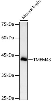 TMEM43 Rabbit mAb