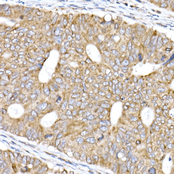 TMEM43 Rabbit mAb