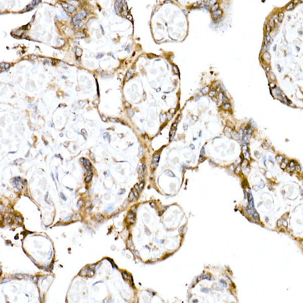 TMEM43 Rabbit mAb