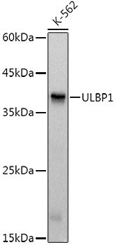 ULBP1 Rabbit mAb
