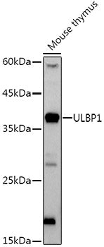 ULBP1 Rabbit mAb