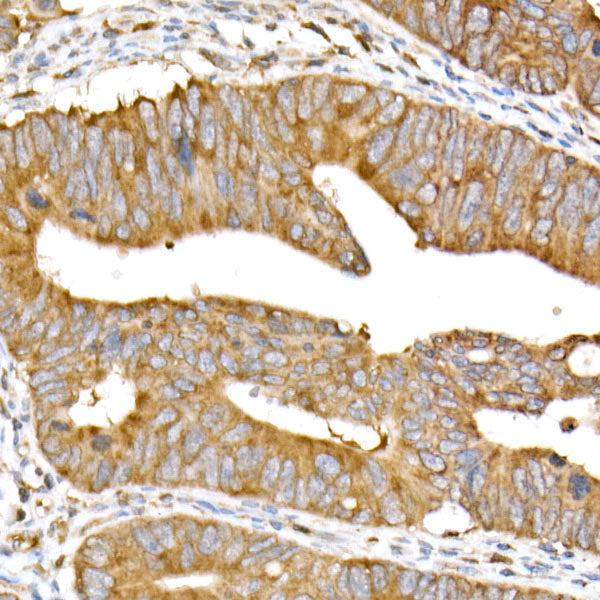 Meckelin Rabbit mAb