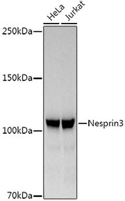 Nesprin3 Rabbit mAb