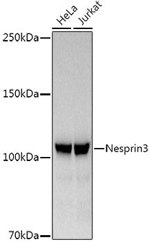 Nesprin3 Rabbit mAb