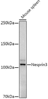 Nesprin3 Rabbit mAb