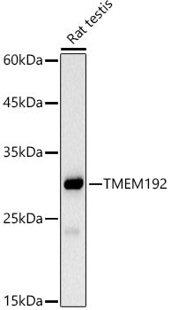 TMEM192 Rabbit mAb