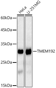 TMEM192 Rabbit mAb