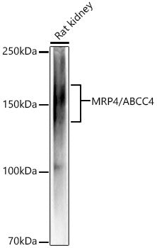 [KD Validated] MRP4/ABCC4 Rabbit mAb