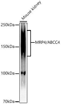 [KD Validated] MRP4/ABCC4 Rabbit mAb