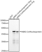 MERS-CoV Nucleoprotein Rabbit mAb