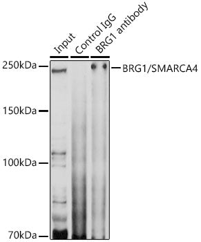 [KO Validated] BRG1/SMARCA4 Rabbit pAb