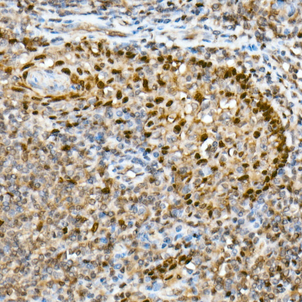HSP70 Rabbit mAb