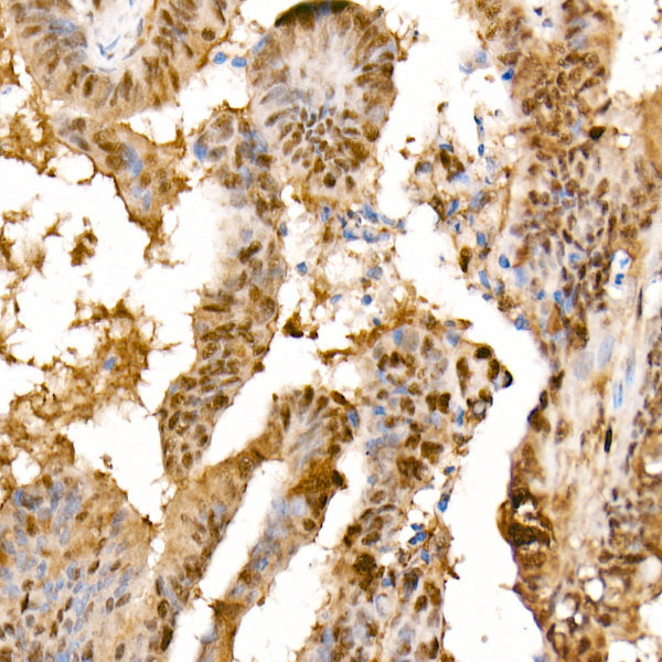 HSP70 Rabbit mAb