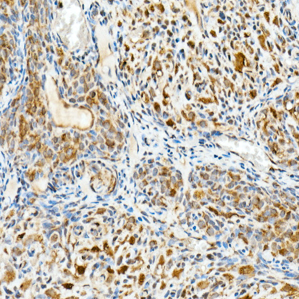 HSP70 Rabbit mAb