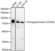 Transglutaminase 2 (TGM2)  Rabbit mAb