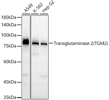 Transglutaminase 2 (TGM2)  Rabbit mAb