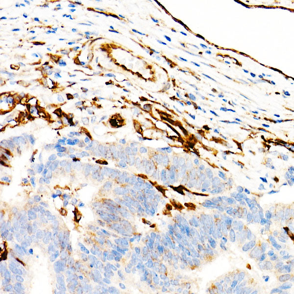 Transglutaminase 2 (TGM2)  Rabbit mAb