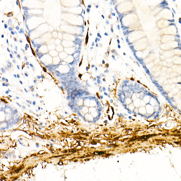 Transglutaminase 2 (TGM2)  Rabbit mAb