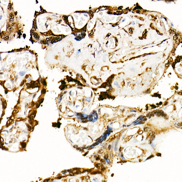 Transglutaminase 2 (TGM2)  Rabbit mAb