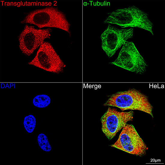 Transglutaminase 2 (TGM2)  Rabbit mAb