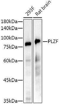 PLZF Rabbit mAb