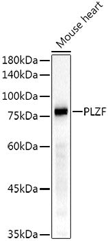 PLZF Rabbit mAb