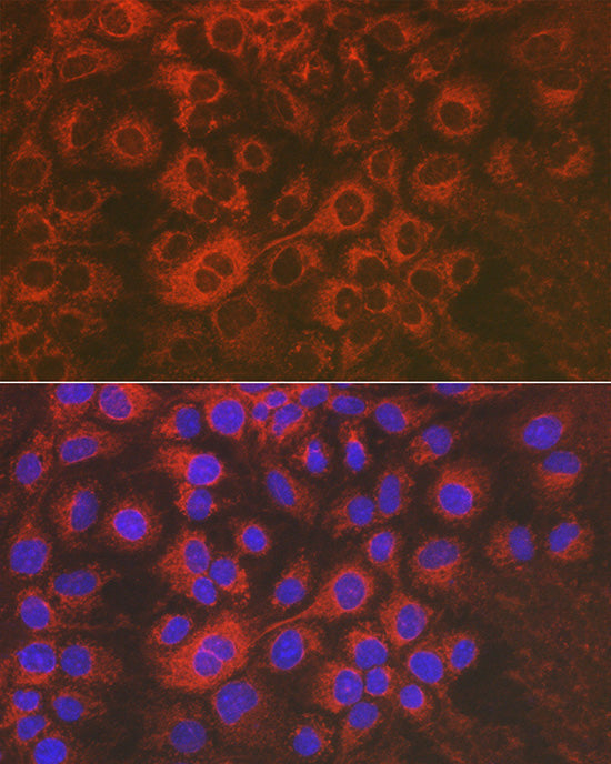 Sorbitol Dehydrogenase Rabbit pAb