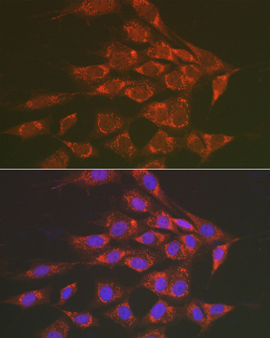 Sorbitol Dehydrogenase Rabbit pAb