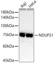 NDUFS1 Rabbit mAb