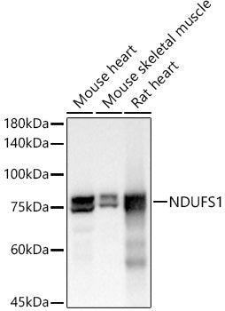 NDUFS1 Rabbit mAb