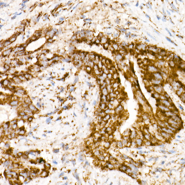 NDUFS1 Rabbit mAb