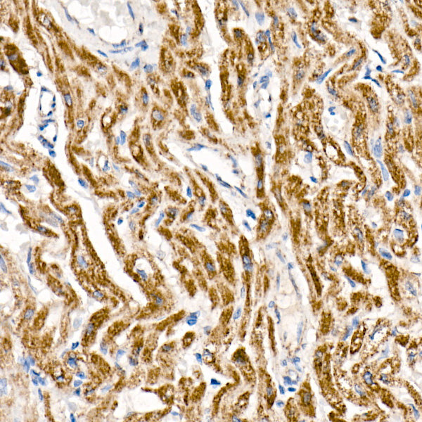 NDUFS1 Rabbit mAb