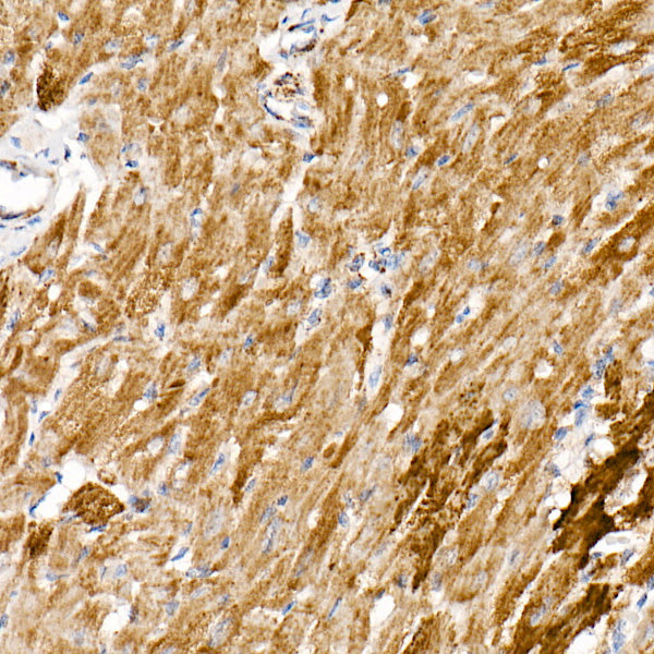 NDUFS1 Rabbit mAb