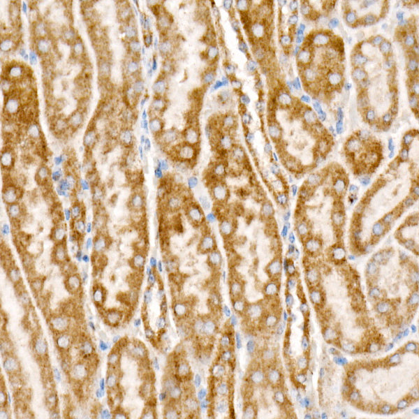 NDUFS1 Rabbit mAb