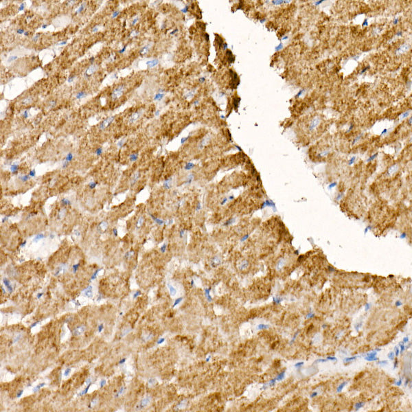 NDUFS1 Rabbit mAb