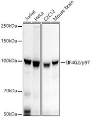 EIF4G2/p97 Rabbit mAb