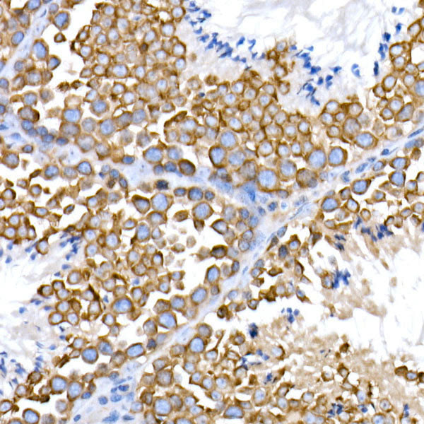 EIF4G2/p97 Rabbit mAb