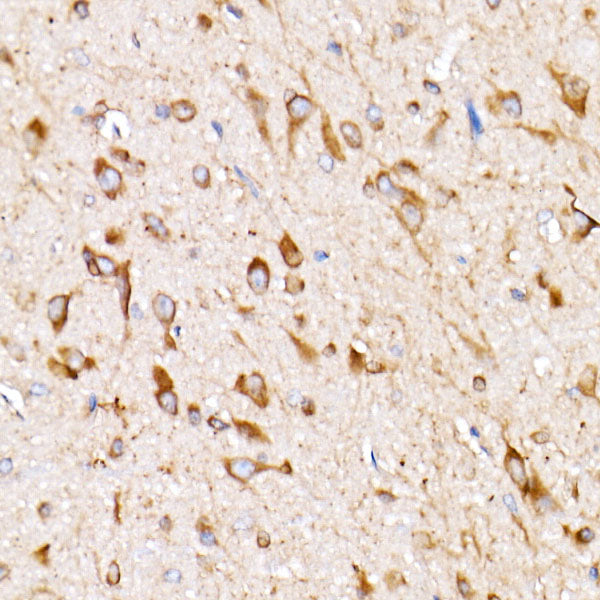 EIF4G2/p97 Rabbit mAb