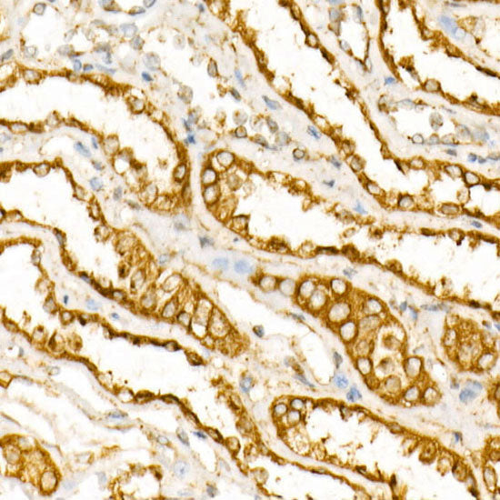 [KD Validated] LAMP1/CD107a Rabbit mAb