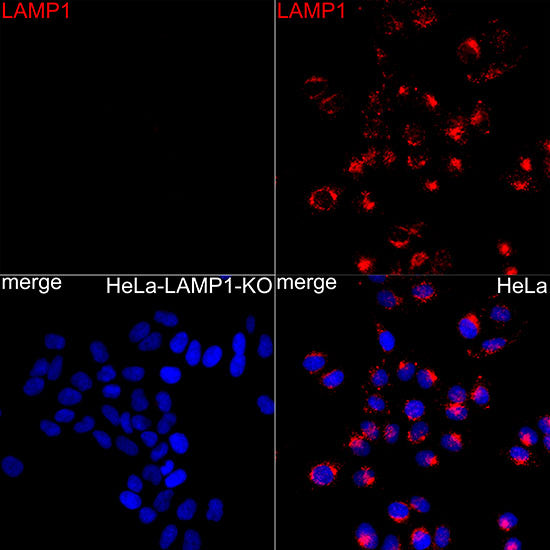 [KD Validated] LAMP1/CD107a Rabbit mAb